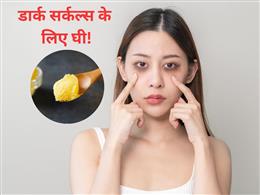 आंखों के नीचे काले घेरे हैं? घी में मिलाकर लगाएं बस ये 1 चीज